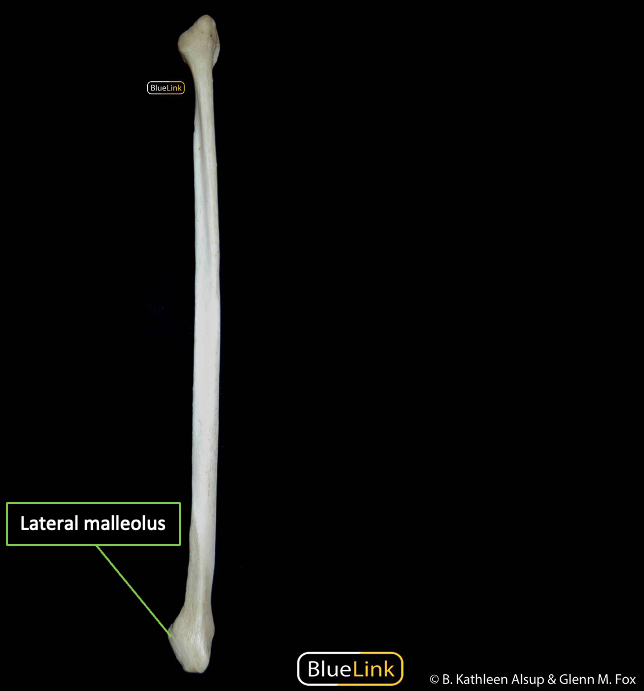 Anterior view of the right fibula with distal bony landmarks identified.