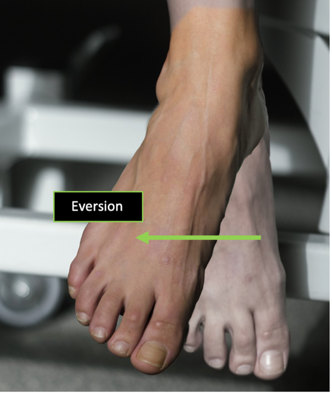 Person demonstrating an anterior view of composite ankle eversion in a position of plantarflexion.