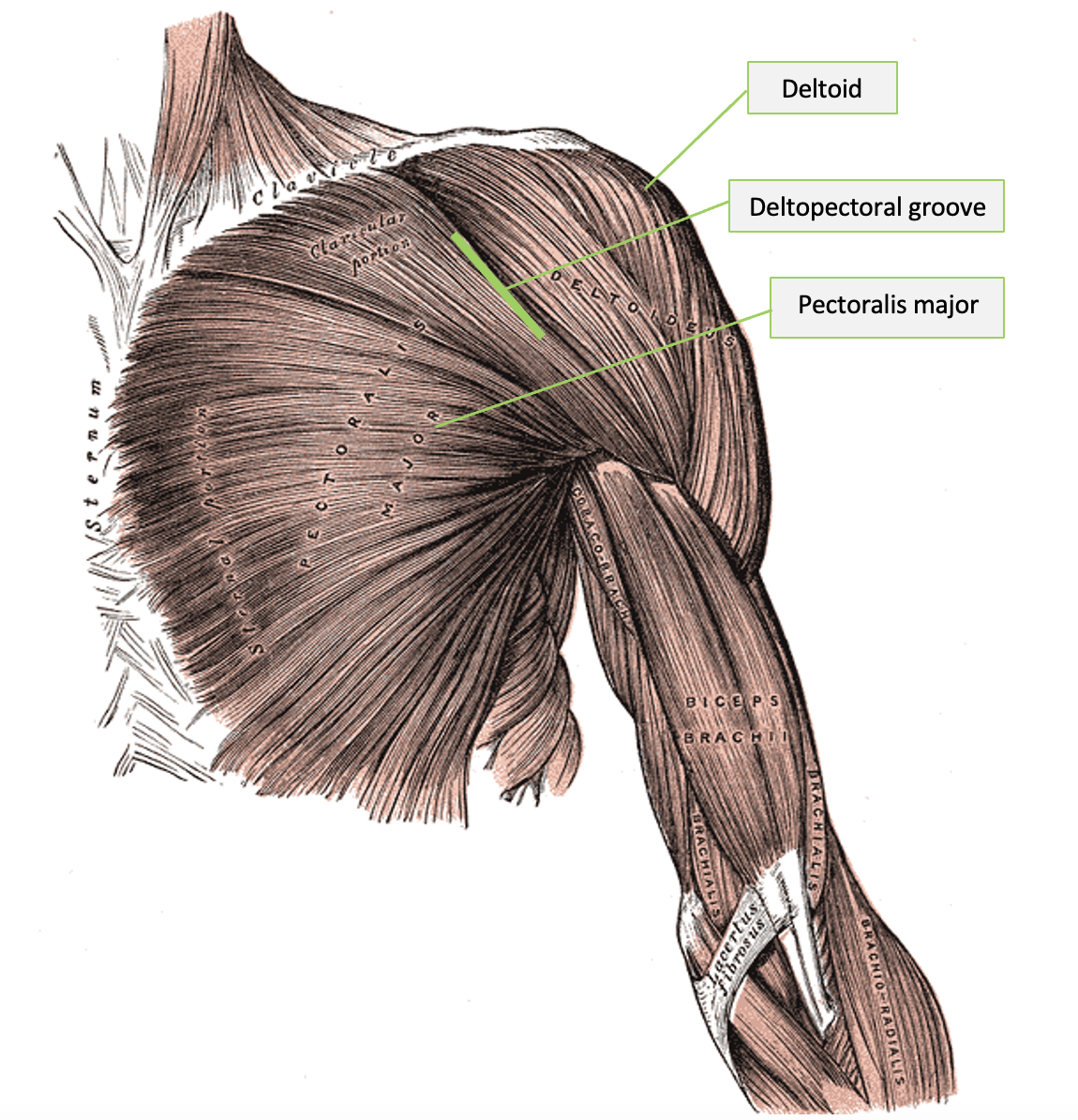 The deltopectoral groove on an illustrated model of the muscles of the anterior left shoulder with the pectoralis major and deltoid muscles identified.