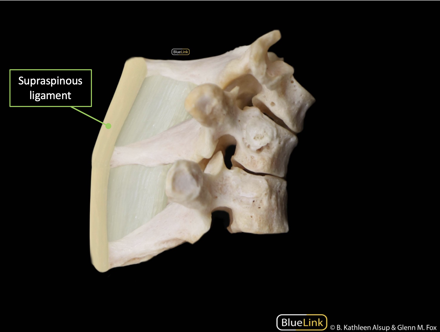 A sagittal view of the supraspinous ligament.