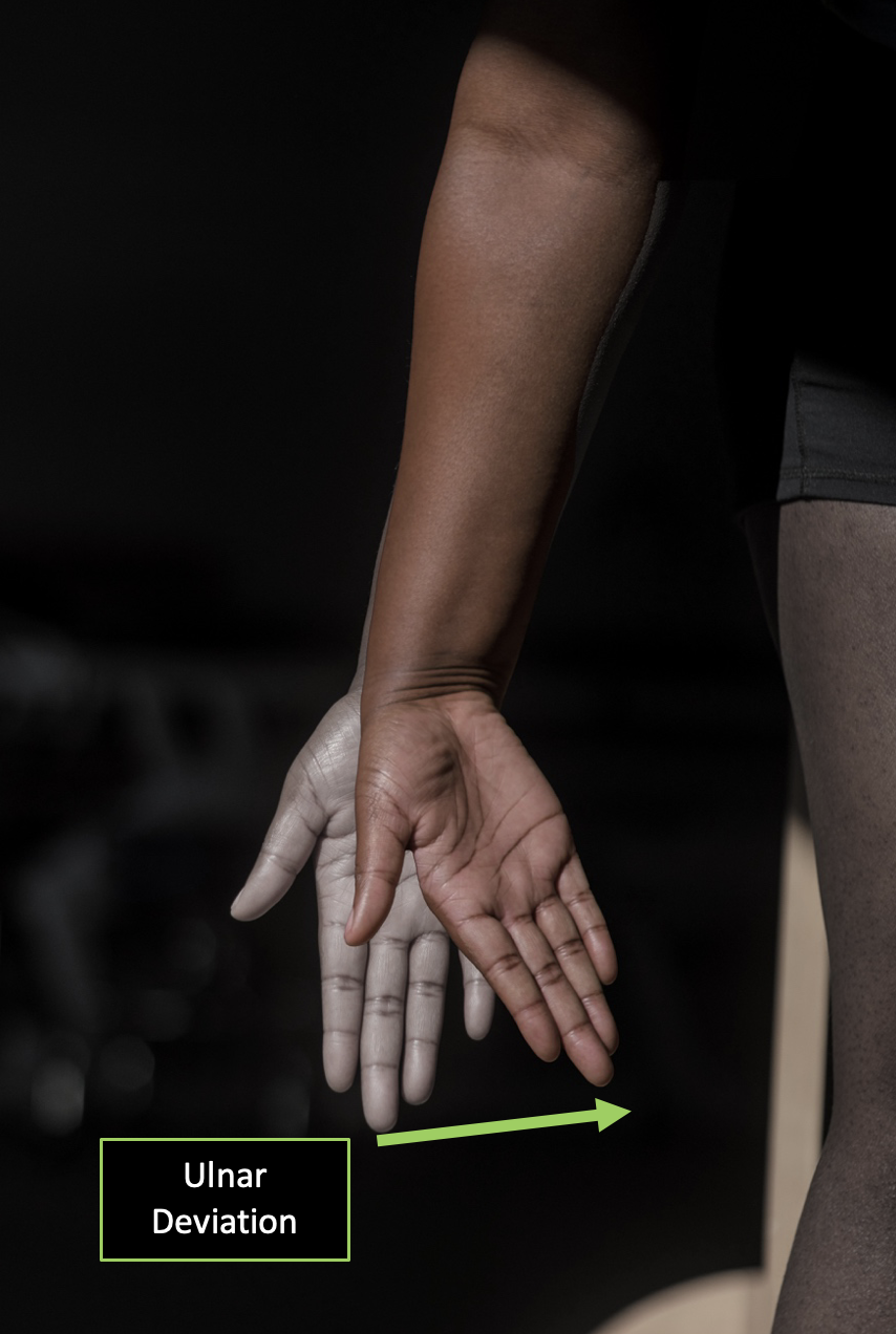 Person demonstrating ulnar deviation from a neutral position with directional arrows in the frontal plane present.