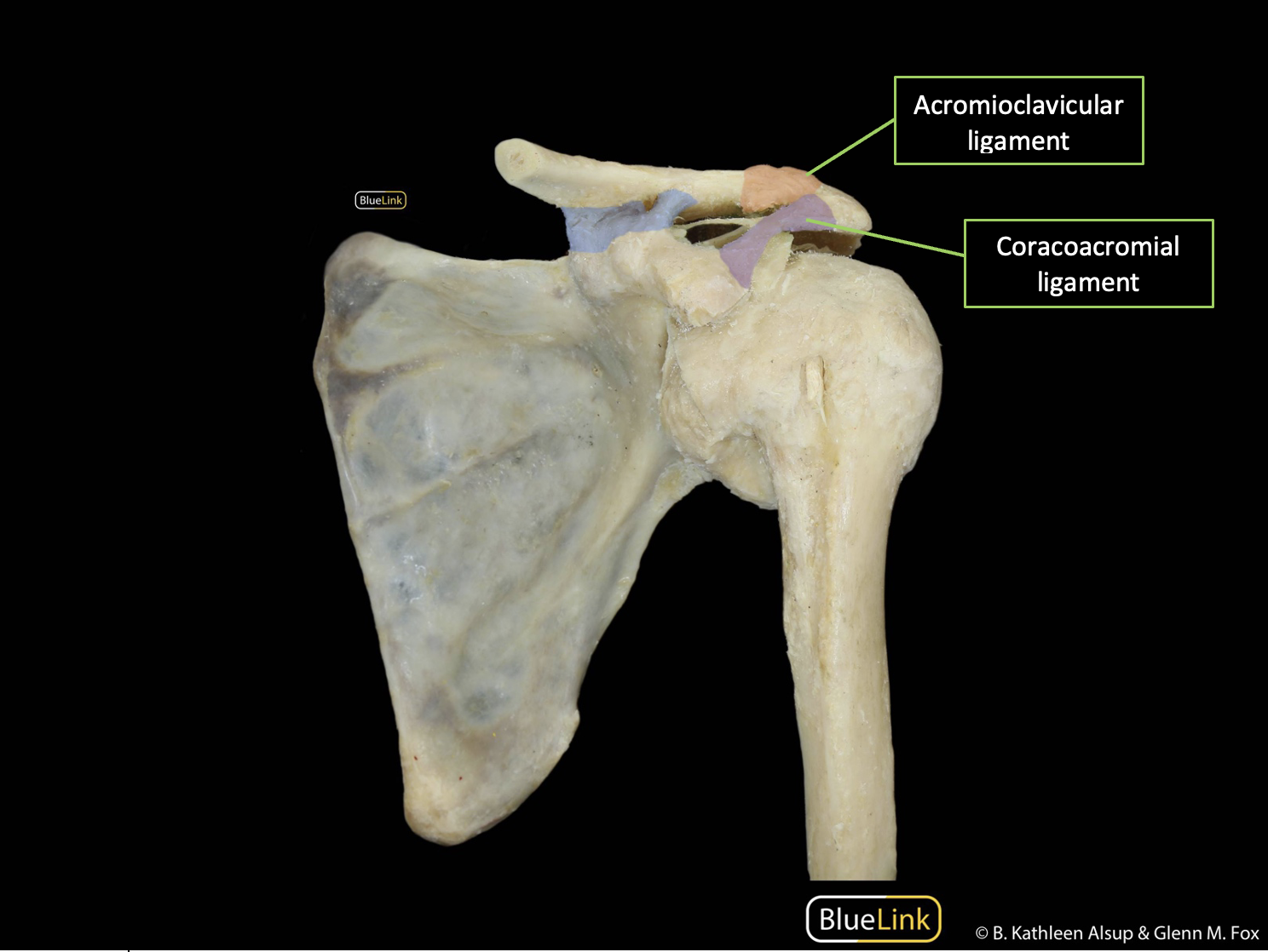 Anterior view of a left scapula, humerus, and acromioclavicular and coracoacromial ligaments with ligaments identified with labels and corresponding lines.