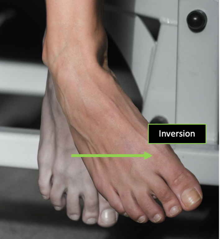 Person demonstrating an anterior view of composite ankle inversion in a position of plantarflexion.