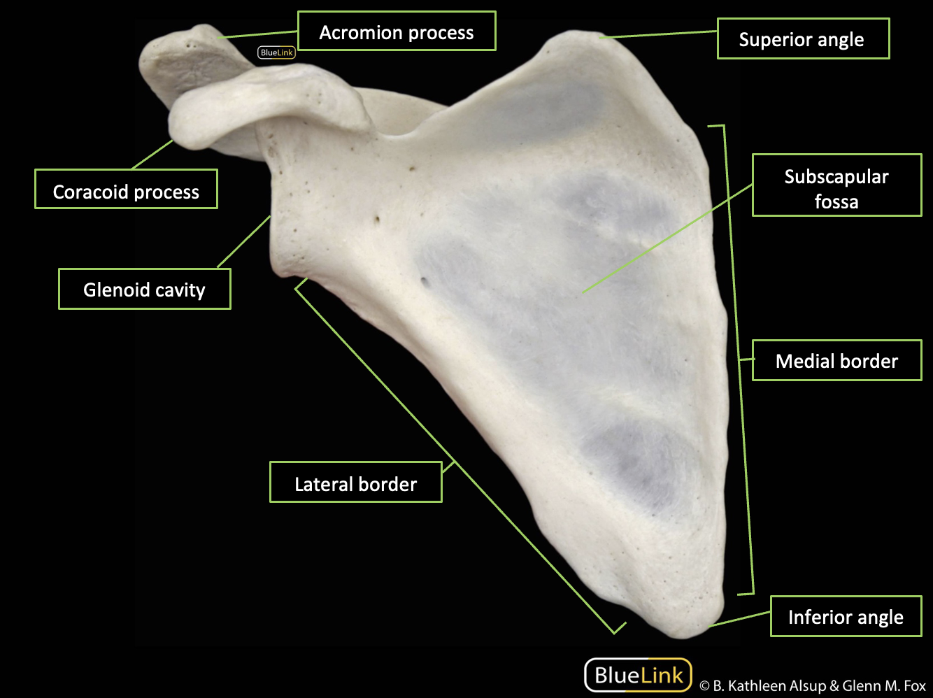 The bony landmarks of the anterior scapula identified with labels and corresponding lines.