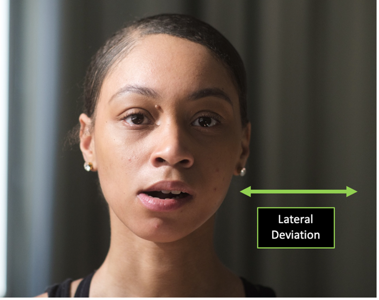 Person demonstrating lateral deviation of the mandible with directional arrows to indicate singular motions.