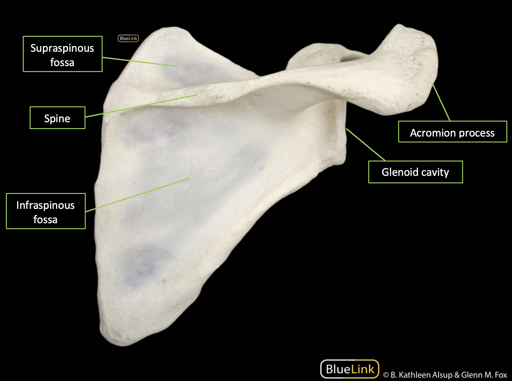 The bony landmarks of the posterior scapula identified with labels and corresponding lines.